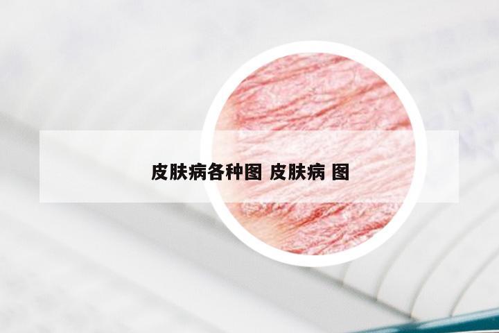 皮肤病各种图 皮肤病 图