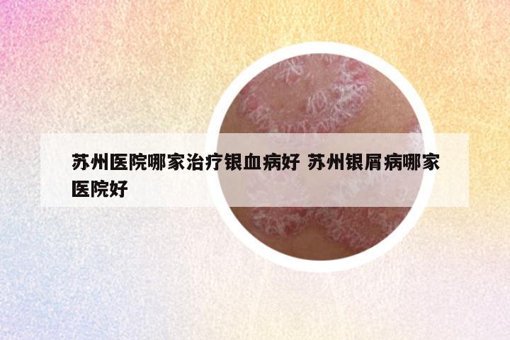 苏州医院哪家治疗银血病好 苏州银屑病哪家医院好