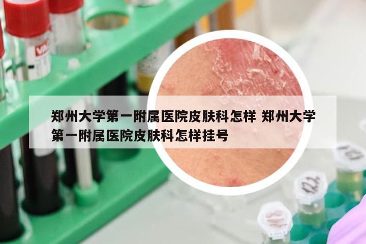 郑州大学第一附属医院皮肤科怎样 郑州大学第一附属医院皮肤科怎样挂号