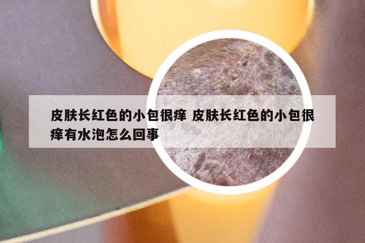 皮肤长红色的小包很痒 皮肤长红色的小包很痒有水泡怎么回事