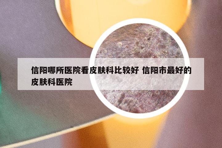 信阳哪所医院看皮肤科比较好 信阳市最好的皮肤科医院