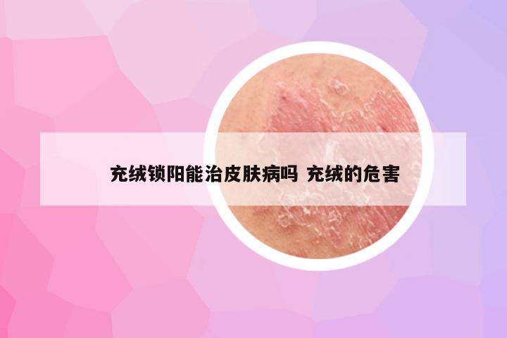 充绒锁阳能治皮肤病吗 充绒的危害