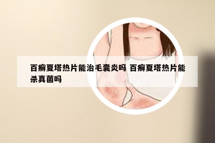 百癣夏塔热片能治毛囊炎吗 百癣夏塔热片能杀真菌吗