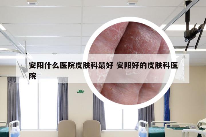 安阳什么医院皮肤科最好 安阳好的皮肤科医院