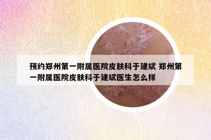 预约郑州第一附属医院皮肤科于建斌 郑州第一附属医院皮肤科于建斌医生怎么样