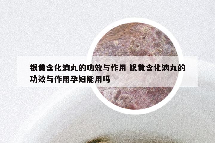 银黄含化滴丸的功效与作用 银黄含化滴丸的功效与作用孕妇能用吗