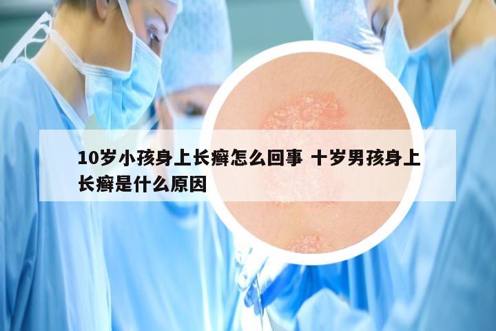 10岁小孩身上长癣怎么回事 十岁男孩身上长癣是什么原因