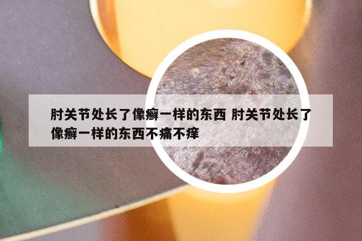 肘关节处长了像癣一样的东西 肘关节处长了像癣一样的东西不痛不痒