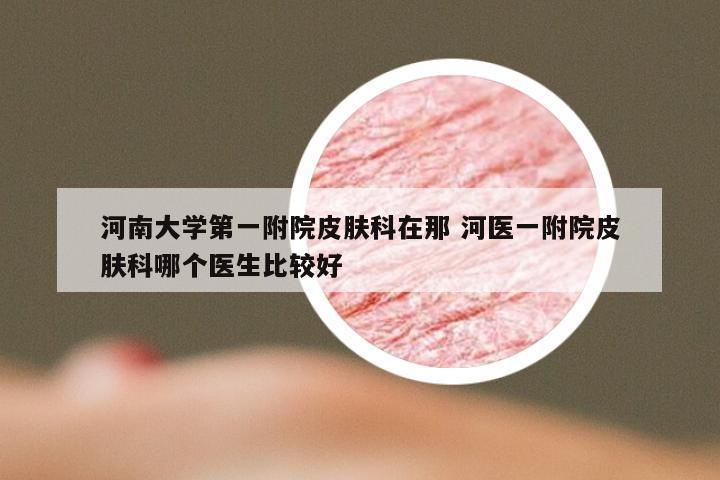 河南大学第一附院皮肤科在那 河医一附院皮肤科哪个医生比较好