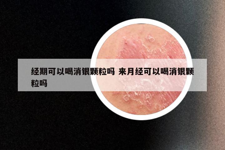 经期可以喝消银颗粒吗 来月经可以喝消银颗粒吗