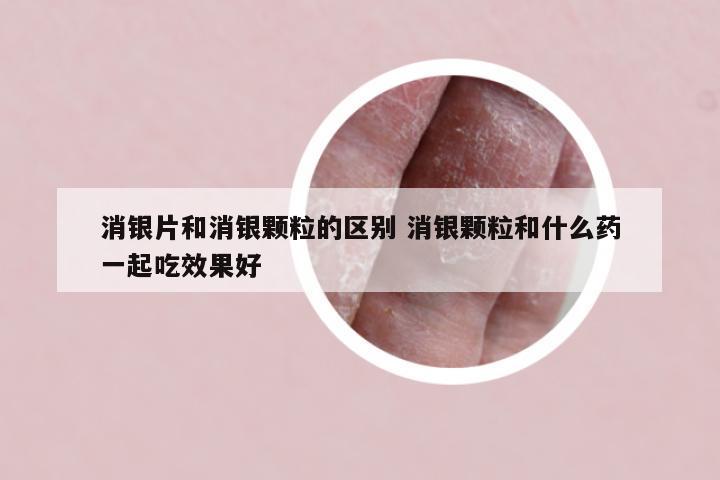 消银片和消银颗粒的区别 消银颗粒和什么药一起吃效果好