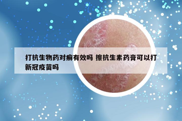 打抗生物药对癣有效吗 擦抗生素药膏可以打新冠疫苗吗