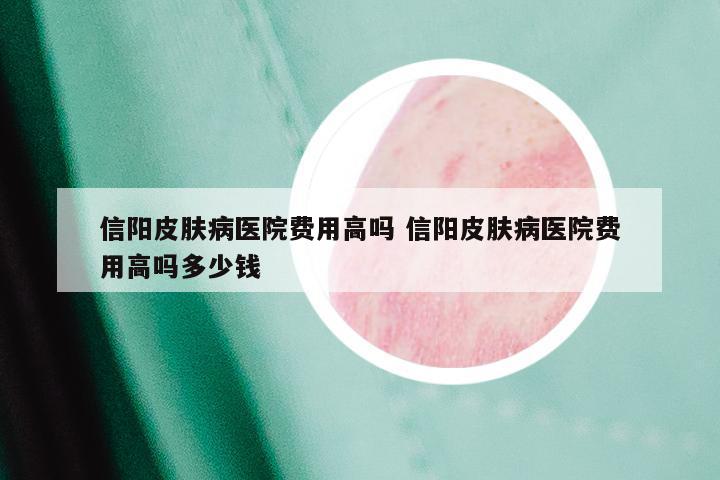 信阳皮肤病医院费用高吗 信阳皮肤病医院费用高吗多少钱