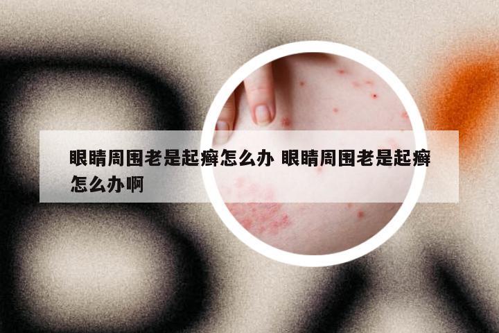 眼睛周围老是起癣怎么办 眼睛周围老是起癣怎么办啊