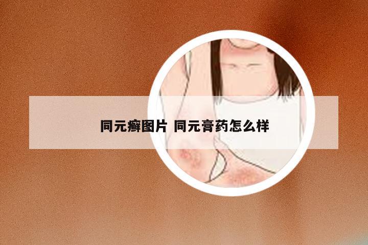 同元癣图片 同元膏药怎么样