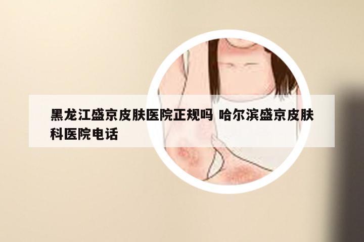 黑龙江盛京皮肤医院正规吗 哈尔滨盛京皮肤科医院电话