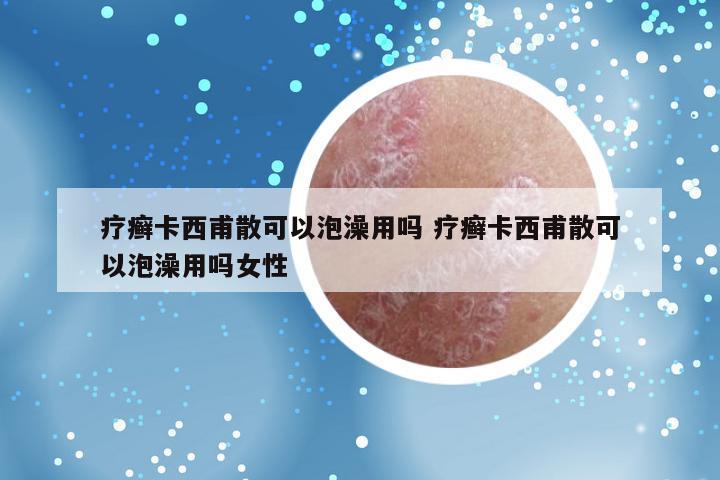 疗癣卡西甫散可以泡澡用吗 疗癣卡西甫散可以泡澡用吗女性