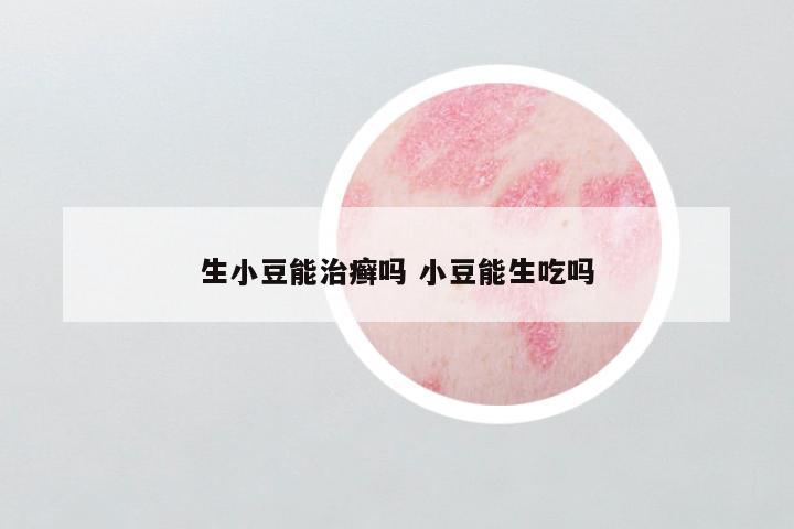 生小豆能治癣吗 小豆能生吃吗