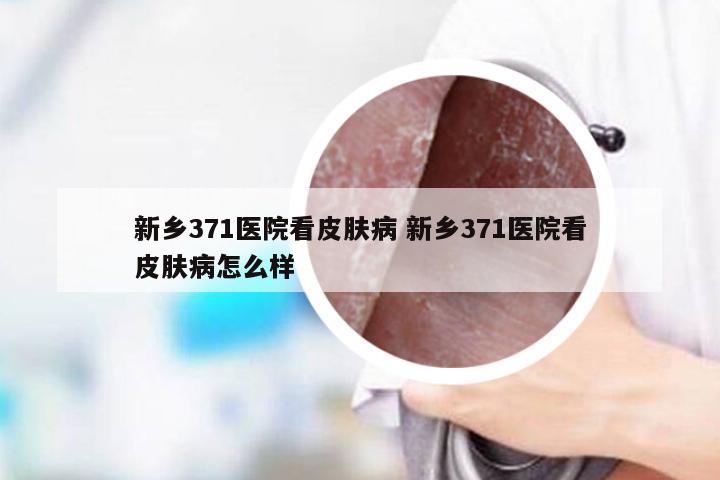 新乡371医院看皮肤病 新乡371医院看皮肤病怎么样