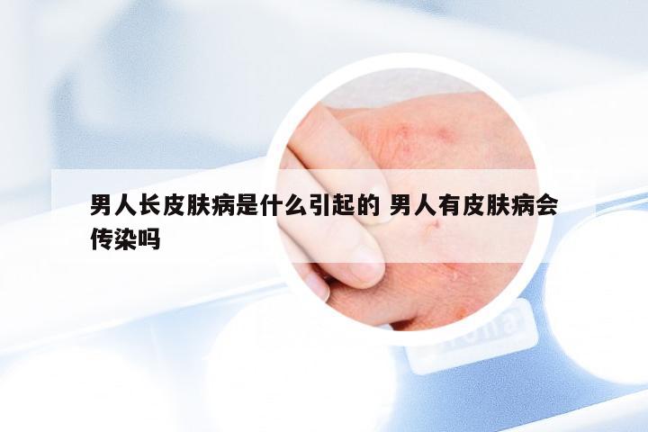 男人长皮肤病是什么引起的 男人有皮肤病会传染吗