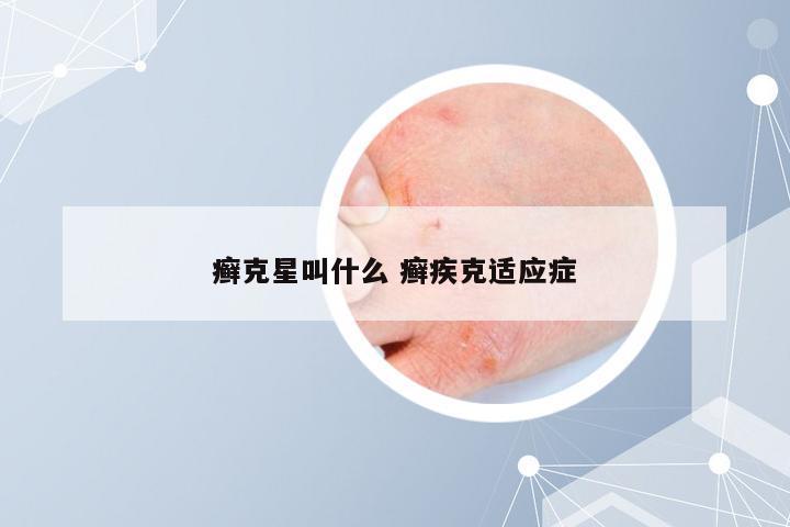 癣克星叫什么 癣疾克适应症