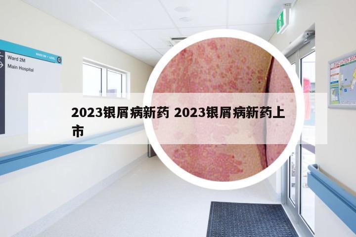 2023银屑病新药 2023银屑病新药上市