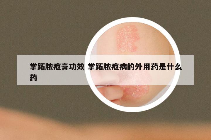 掌跖脓疱膏功效 掌跖脓疱病的外用药是什么药