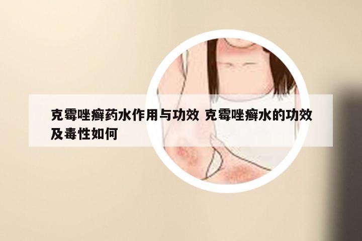 克霉唑癣药水作用与功效 克霉唑癣水的功效及毒性如何