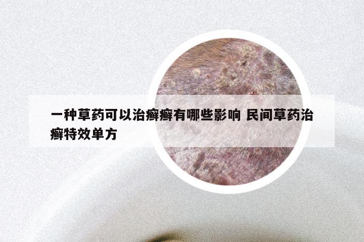 一种草药可以治癣癣有哪些影响 民间草药治癣特效单方