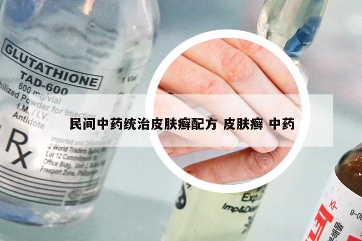 民间中药统治皮肤癣配方 皮肤癣 中药