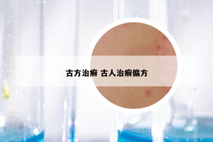 古方治癣 古人治癣偏方