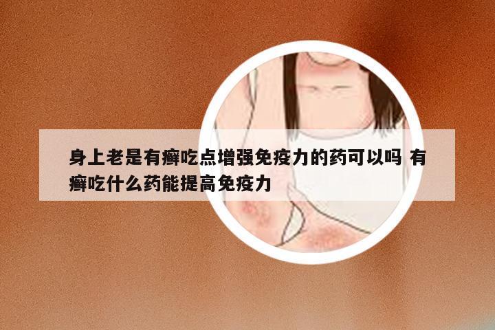 身上老是有癣吃点增强免疫力的药可以吗 有癣吃什么药能提高免疫力