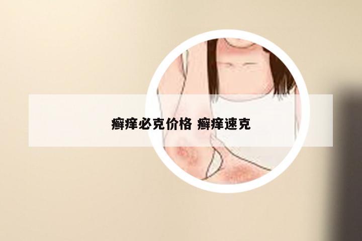 癣痒必克价格 癣痒速克