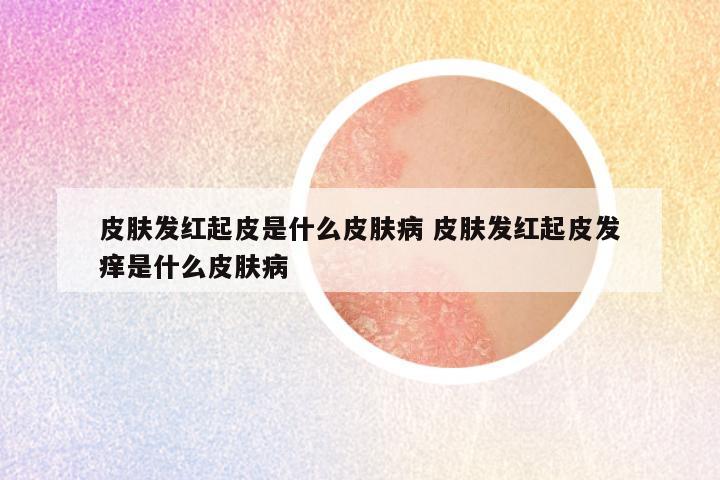 皮肤发红起皮是什么皮肤病 皮肤发红起皮发痒是什么皮肤病