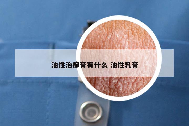 油性治癣膏有什么 油性乳膏