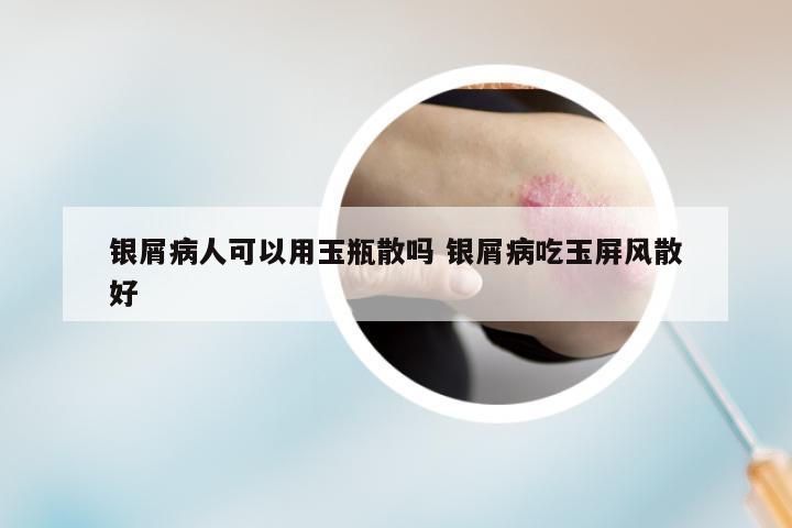 银屑病人可以用玉瓶散吗 银屑病吃玉屏风散好