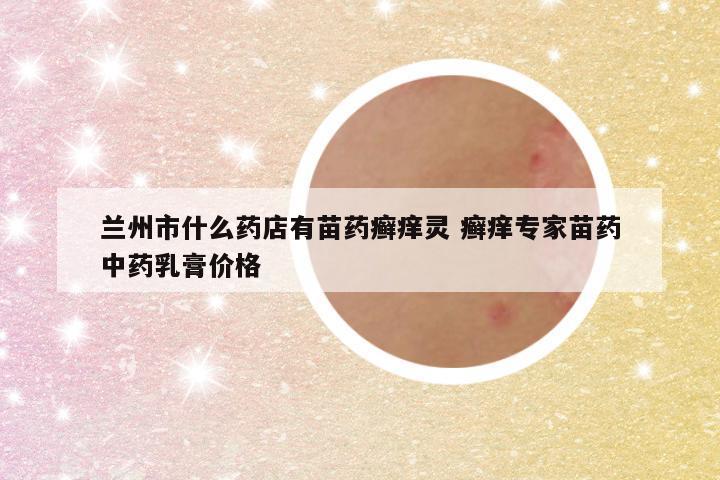 兰州市什么药店有苗药癣痒灵 癣痒专家苗药中药乳膏价格