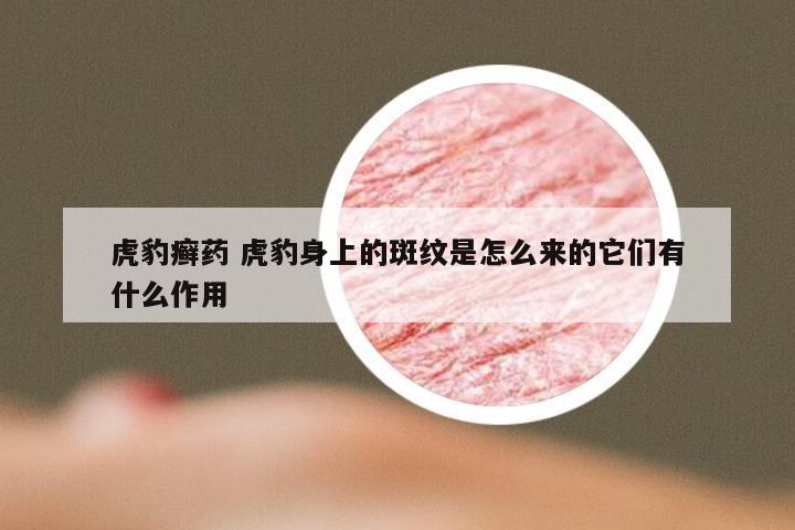 虎豹癣药 虎豹身上的斑纹是怎么来的它们有什么作用