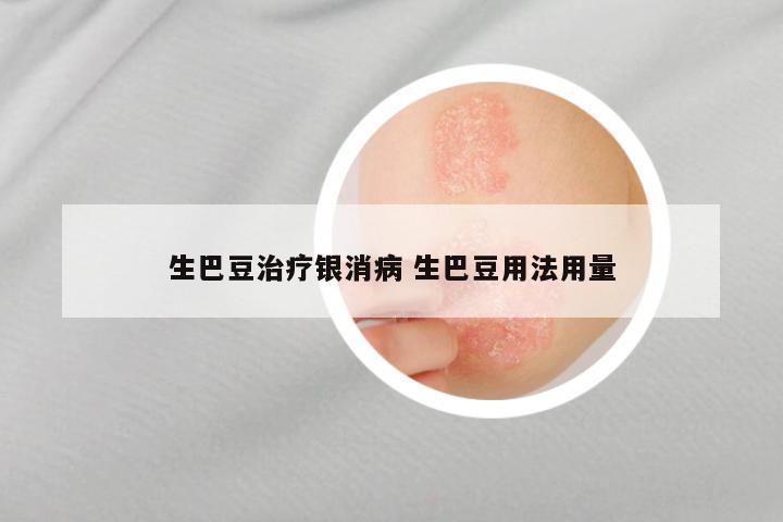 生巴豆治疗银消病 生巴豆用法用量