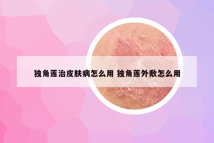 独角莲治皮肤病怎么用 独角莲外敷怎么用