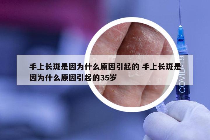 手上长斑是因为什么原因引起的 手上长斑是因为什么原因引起的35岁