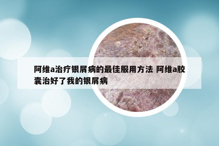 阿维a治疗银屑病的最佳服用方法 阿维a胶囊治好了我的银屑病