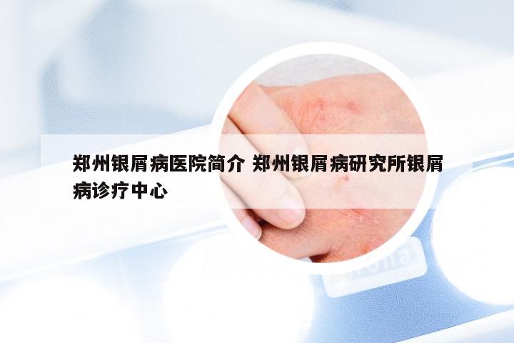 郑州银屑病医院简介 郑州银屑病研究所银屑病诊疗中心