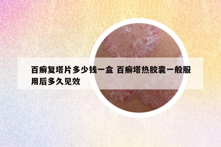 百癣复塔片多少钱一盒 百癣塔热胶囊一般服用后多久见效