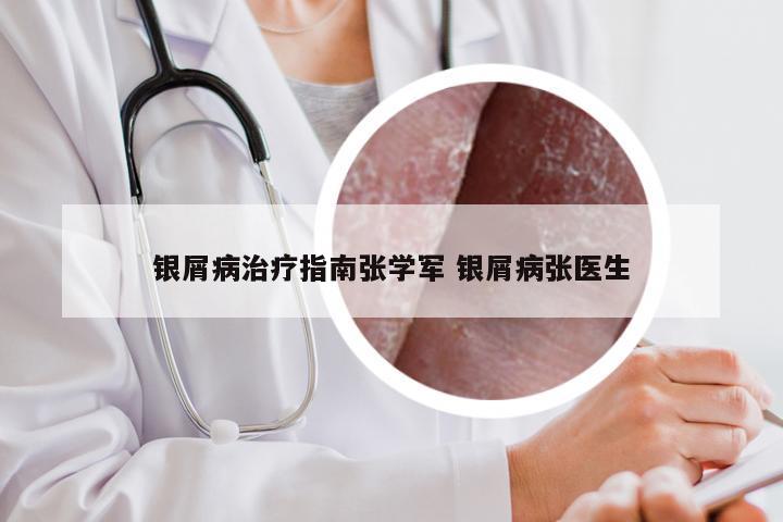 银屑病治疗指南张学军 银屑病张医生