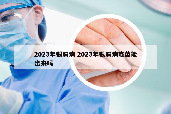 2023年银屑病 2023年银屑病疫苗能出来吗