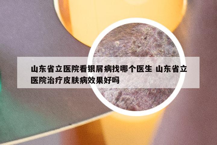 山东省立医院看银屑病找哪个医生 山东省立医院治疗皮肤病效果好吗