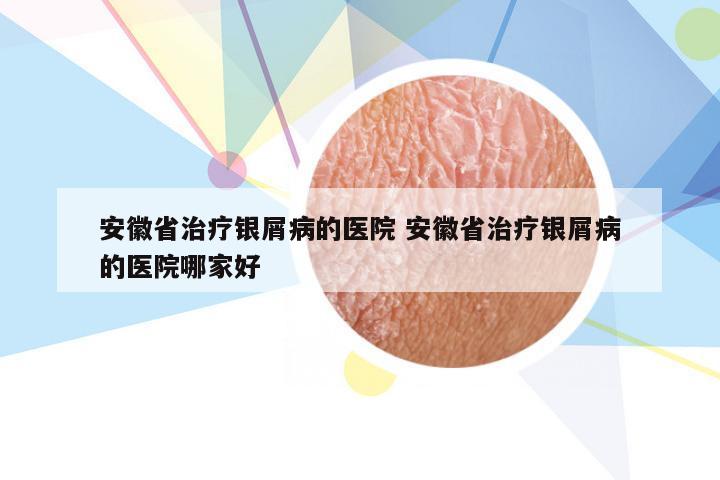 安徽省治疗银屑病的医院 安徽省治疗银屑病的医院哪家好