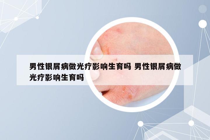 男性银屑病做光疗影响生育吗 男性银屑病做光疗影响生育吗