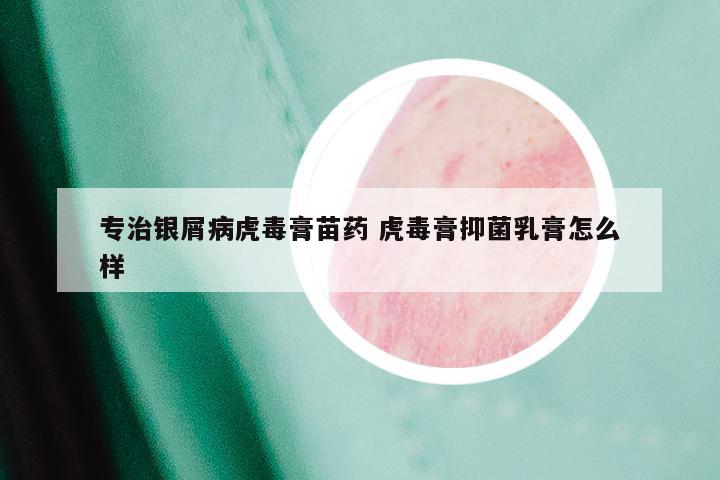 专治银屑病虎毒膏苗药 虎毒膏抑菌乳膏怎么样